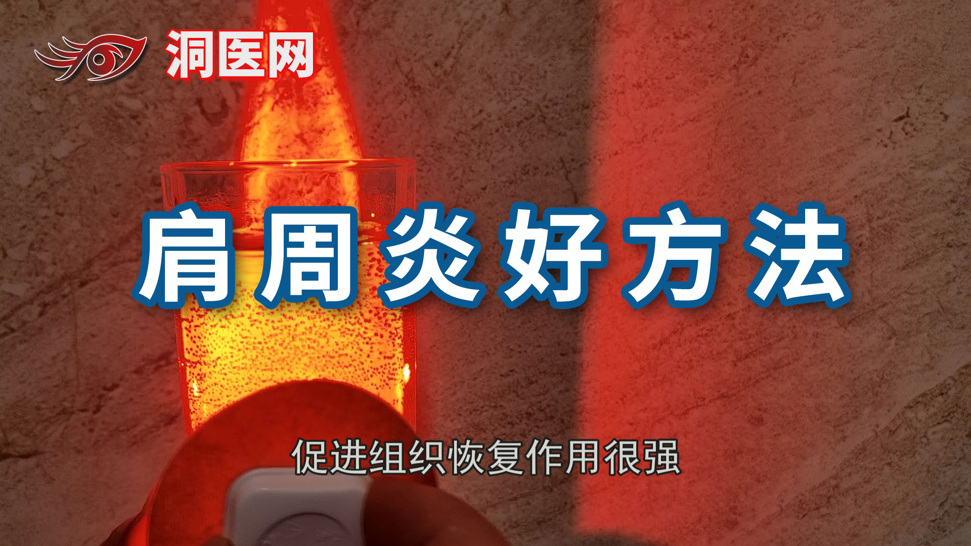 肩周炎会出现肿吗_议美网